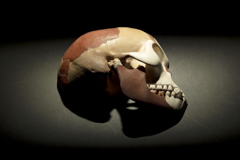Harry Brookes Allen Museum of Anatomy and Pathology online collection_skullduggery.